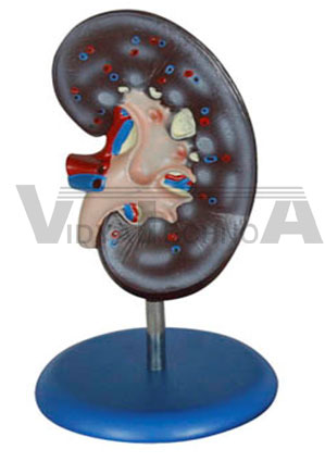 Kidney Model (1 Part) Pharmaceutical and Anatomical Model Gifts